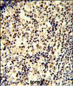 SNRPD1 Polyclonal Antibody
