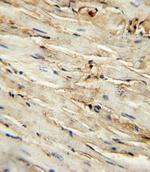 CD105 Polyclonal Antibody