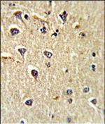 CD166 Antibody in Immunohistochemistry (Paraffin) (IHC (P))
