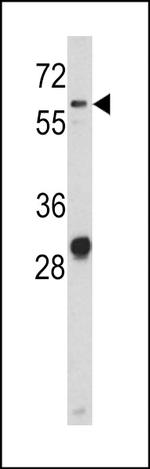 CD166 Antibody in Western Blot (WB)