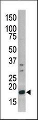 Phospho-Histone H3 (Ser10) Antibody in Western Blot (WB)