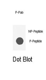 Phospho-AKT1 (Ser129) Antibody in Dot Blot (DB)