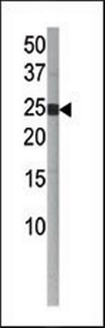 Phospho-BID (Ser65) Antibody in Western Blot (WB)