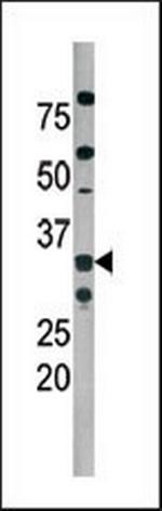 Phospho-CDK2 (Thr160) Antibody in Western Blot (WB)