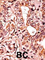 Phospho-CDK7 (Thr170) Polyclonal Antibody