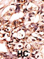 Phospho-DAXX (Ser213) Polyclonal Antibody