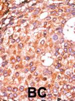 Phospho-E2F1 (Ser337) Antibody in Immunohistochemistry (Paraffin) (IHC (P))