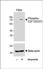 Phospho-E2F1 (Ser337) Antibody in Western Blot (WB)