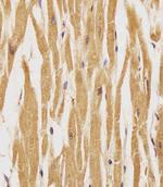 Phospho-ErbB4 (Tyr1162) Antibody in Immunohistochemistry (Paraffin) (IHC (P))