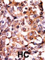 Phospho-MAPKAPK2 (Ser272) Polyclonal Antibody