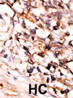 Phospho-PRAK (Ser93) Polyclonal Antibody