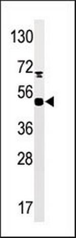 Phospho-PRAK (Ser93) Antibody in Western Blot (WB)