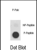 Phospho-c-Met (Tyr1356) Antibody in Dot Blot (DB)