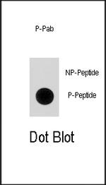 Phospho-p21 (Ser130) Antibody in Dot Blot (DB)