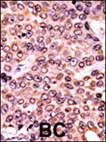 Phospho-p21 (Thr145) Antibody in Immunohistochemistry (Paraffin) (IHC (P))