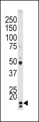 Phospho-p21 (Thr145) Antibody in Western Blot (WB)