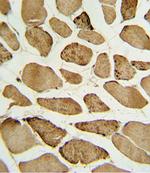 Phospho-p27 Kip1 (Ser10) Antibody in Immunohistochemistry (Paraffin) (IHC (P))