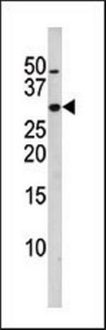 Phospho-p27 Kip1 (Ser10) Antibody in Western Blot (WB)