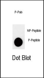 Phospho-p27 Kip1 (Thr157) Antibody in Dot Blot (DB)