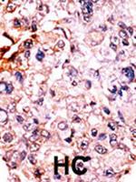 Phospho-p27 Kip1 (Thr187) Antibody in Immunohistochemistry (Paraffin) (IHC (P))