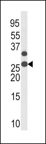Phospho-p27 Kip1 (Thr187) Antibody in Western Blot (WB)
