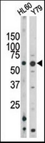 Phospho-RAD9 (Ser328) Antibody in Western Blot (WB)