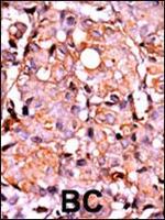 Phospho-RAD9 (Ser387) Antibody in Immunohistochemistry (Paraffin) (IHC (P))