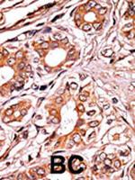 Phospho-Rb (Ser249) Antibody in Immunohistochemistry (Paraffin) (IHC (P))