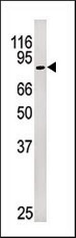 Phospho-Rb (Ser249) Antibody in Western Blot (WB)