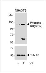 Phospho-Rb (Ser612) Antibody in Western Blot (WB)