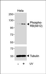 Phospho-Rb (Ser612) Antibody in Western Blot (WB)