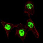 Phospho-SMAD3 (Ser208) Polyclonal Antibody