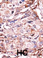 Phospho-SMAD3 (Ser213) Polyclonal Antibody