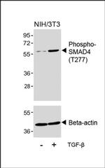 Phospho-SMAD4 (Thr277) Polyclonal Antibody
