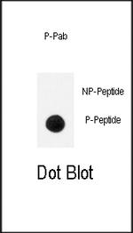Phospho-TrkA (Tyr791) Antibody in Dot Blot (DB)