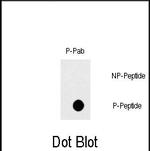 Phospho-FAS (Tyr291) Antibody in Dot Blot (DB)