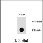 Phospho-PAK1 (Thr212) Antibody in Dot Blot (DB)