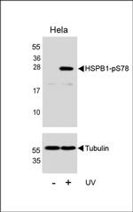 Phospho-HSP27 (Ser78) Antibody in Western Blot (WB)