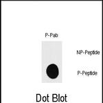 Phospho-p70 S6 Kinase (Ser418) Antibody in Dot Blot (DB)