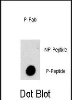 Phospho-VPS34 (Ser282) Polyclonal Antibody