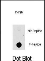 Phospho-TPL2 (Thr290) Polyclonal Antibody