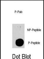 Phospho-TSC2 (Ser939) Antibody in Dot Blot (DB)
