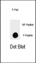 Phospho-TSC2 (Ser664) Antibody in Dot Blot (DB)