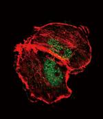 Phospho-TSC2 (Ser664) Polyclonal Antibody