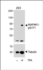 Phospho-HPK1 (Ser171) Antibody in Western Blot (WB)
