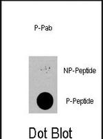 Phospho-PDPK1 (Ser396) Polyclonal Antibody