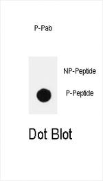 Phospho-PIK3CD (Tyr485) Polyclonal Antibody