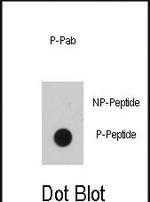 Phospho-EGFR (Tyr1016) Antibody in Dot Blot (DB)