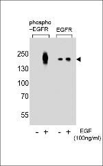 Phospho-EGFR (Tyr1016) Antibody in Western Blot (WB)