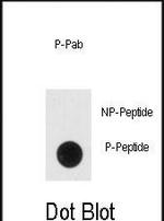 Phospho-NSE (Tyr236) Antibody in Dot Blot (DB)